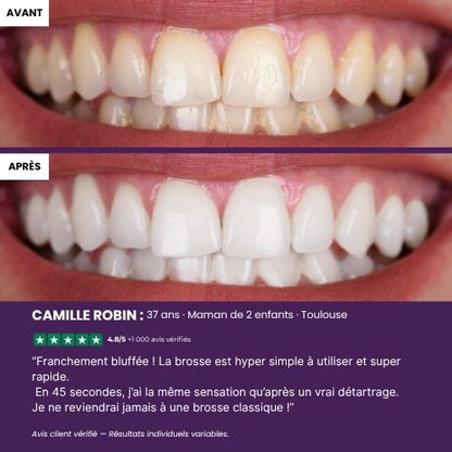 UBrush™ – Brosse à dents automatique LED 360°